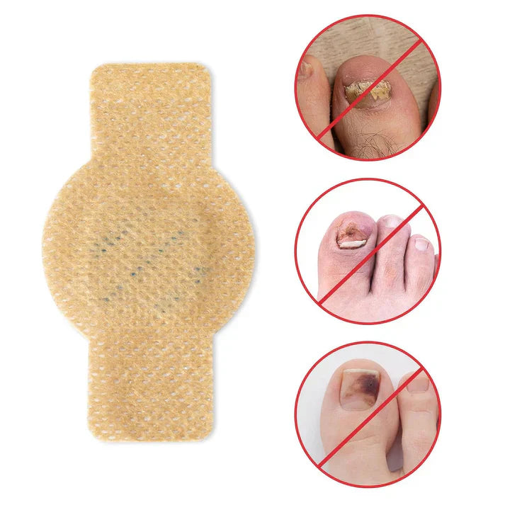 NailHeal™ - Fungal Nail Patches 🌿💅