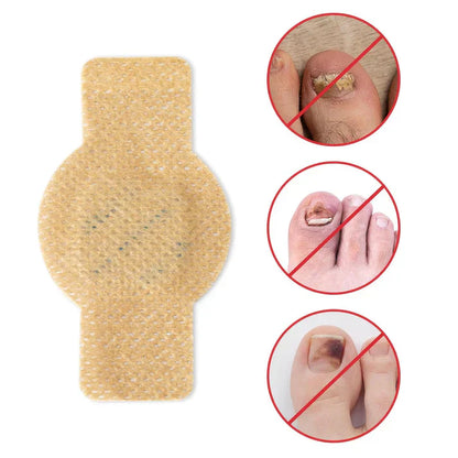 NailHeal™ - Fungal Nail Patches 🌿💅